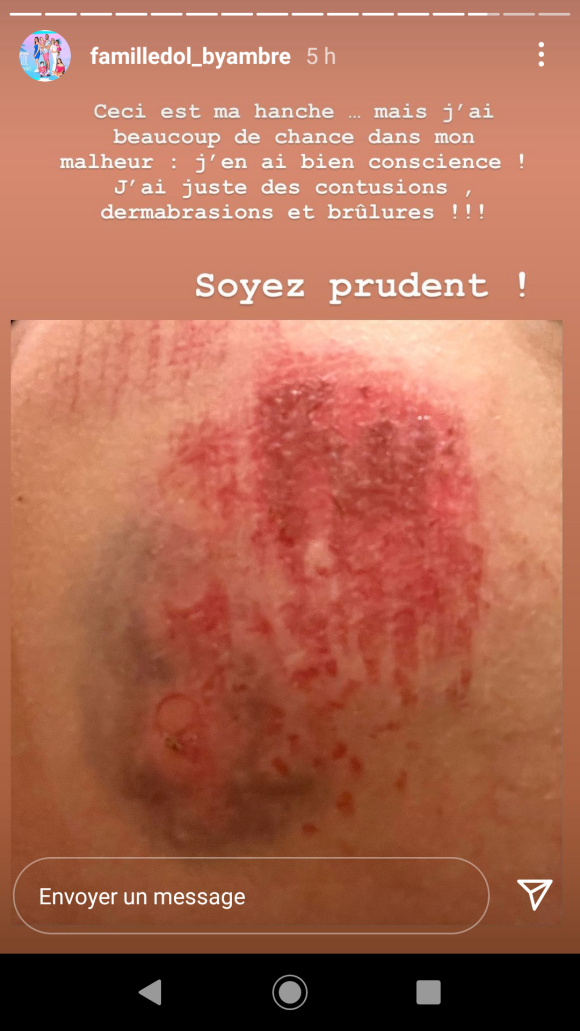 Ambre Dol de "Familles nombreuses" se confie sur l'accident de moto dont son mari Alexandre et elle ont été victimes - Instagram, le 17 octobre 2021