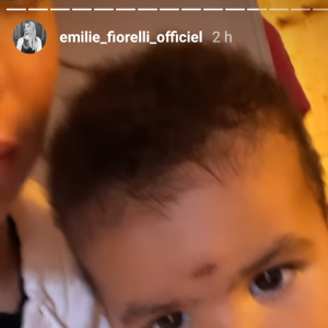 Emilie Fiorelli dévoile que ses deux enfants sont blessés