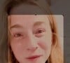 Aurore Morisse s'est dévoilée avec les "yeux bouffis" et remplis de larmes, sur Instagram, le 13 mars 2023