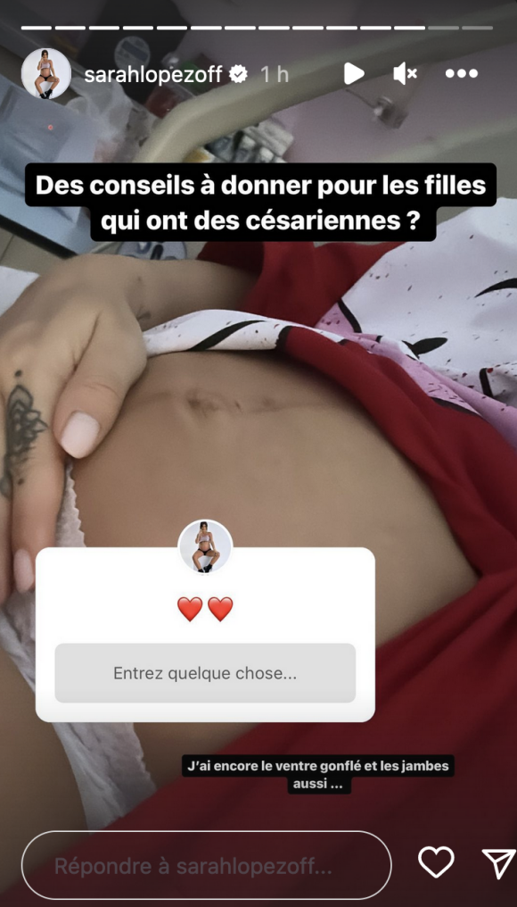 Un peu plus tard, et sans filtre, elle a posté une image très intime de son ventre "encore gonflé".
Sarah Lopez a accueilli une petite fille avec son compagnon Gérald Martinez. Instagram