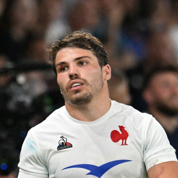 La sanction tombe pour l'auteur de la faute sur Antoine Dupont
 
Antoine Dupont (france) - : France vs Ecosse (30-27) - Match préparatif pour la coupe du monde à Saint-Étienne. © Frédéric Chambert / Panoramic / Bestimage