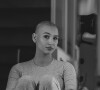 Sur Instagram, la jeune femme prend la pose le crâne rasé.
La candidate de télé-réalité Eloïse Appelle, compagne d'Anthony Nacca, révèle souffrir d'un cancer du sein agressif.