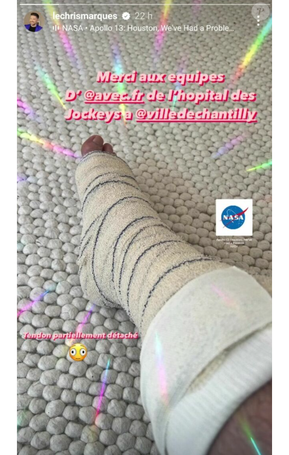 S'il ne précise pas ce qui lui est arrivé, il dévoile une photo de son pied presque entièrement bandé et immobilisé.
Chris Marques indique s'être lourdement blessé. Instagram