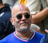 Après s'être rendu à l'hôpital, Pascal Obispo est opéré par un chirurgien urologue
 
Pascal Obispo - Célébrités dans les tribunes du huitième de finale de l'Euro 2024 entre la France et la Belgique (1-0) à Dusseldorf le 1er juillet 2024.