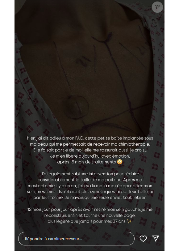 En story
Caroline Receveur donne de ses nouvelles sur "Instagram", ce vendredi 15 novembre 2024.