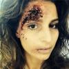 Laury Thilleman, défigurée pour les besoins du tournage d'Alice Nevers : Le juge est une femme sur TF1. Photo postée sur Instagram le lundi 31 mars 2014.