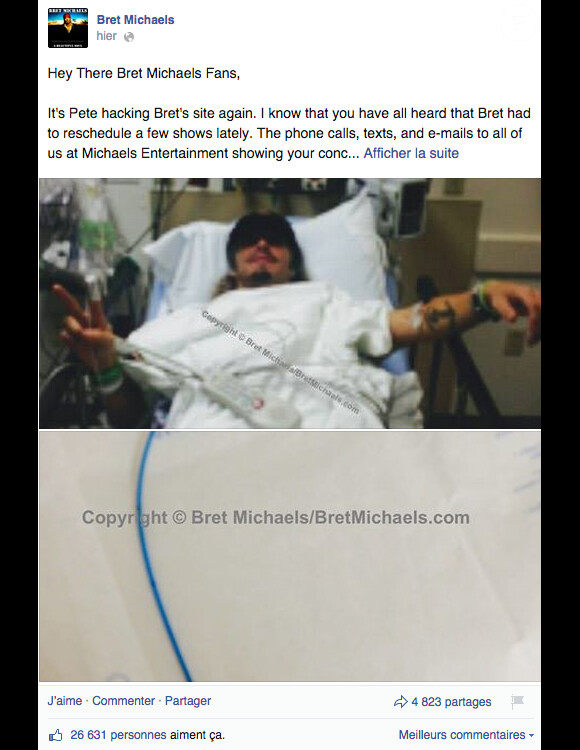 Message posté sur la page Facebook de Bret Michaels concernant son état de santé le 10 novembre 2014.