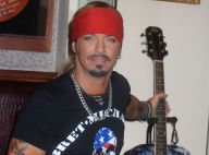 Bret Michaels encore malade : Le rockeur opéré... six fois en deux semaines