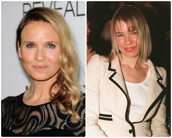 Renée Zellweger en 2011 à l'époque du premier Bridget Jones, et désormais en octobre 2014, méconnaissable.