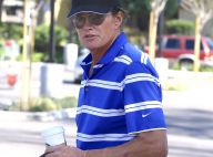 Bruce Jenner transformé en femme : Il s'est fait refaire le nez