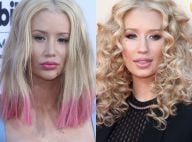 Iggy Azalea : La bombe a subi une nouvelle opération de chirurgie esthétique