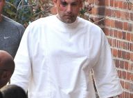 Ben Affleck, le visage ensanglanté en plein tournage...