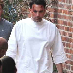 Ben Affleck, le visage en sang, sur le tournage de 'Live By Night' à Los Angeles, le 8 décembre 2015