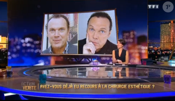 Julien Leprs parle de ses implants dans Action ou vérité, le 18 mars 2016 sur TF1.