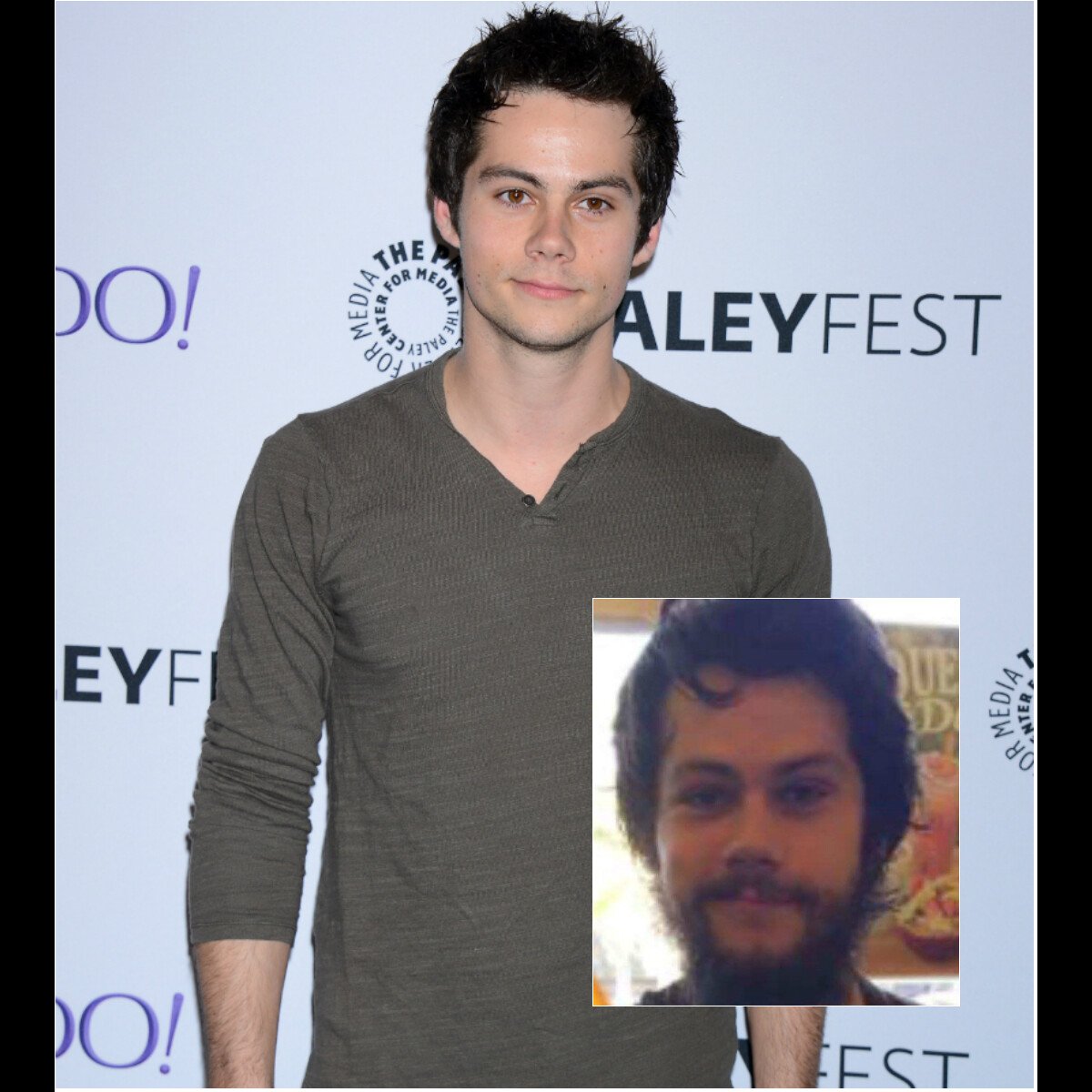 Photo Dylan O'Brien, grièvement blessé après un accident sur le