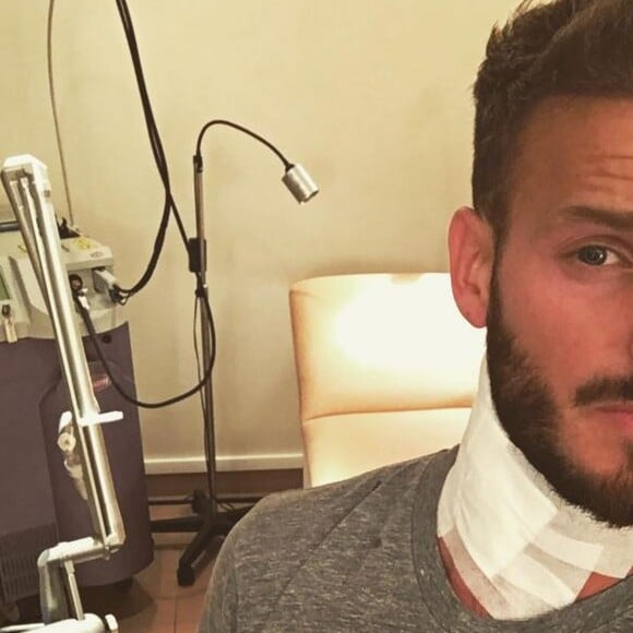 M. Pokora en pleine séance de laser pour faire enlever son tatouage : il fait part de sa souffrance sur son compte Instagram, le 2 avril 2016