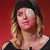 Gessica Notaro, attaquée à l'acide par son ex-compagnon en janvier dernier, dévoile son visage quelques mois après son agression dans une émission de télé italienne - Image extraite d'une vidéo publiée sur Youtube le 21 avril 2017