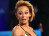 Mel B : Son visage étonnamment transformé, lourds soupçons de chirurgie...