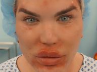 Rodrigo Alves : La nouvelle opération choc du "Ken humain"