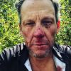 Lance Armstrong a fait une grave chute à vélo ce mercredi 8 août à Snowmass Village, dans le Colorado. L'ex-cycliste a été hospitalisé.