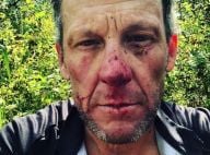 Lance Armstrong hospitalisé : Lourde chute à vélo, il révèle les dégâts