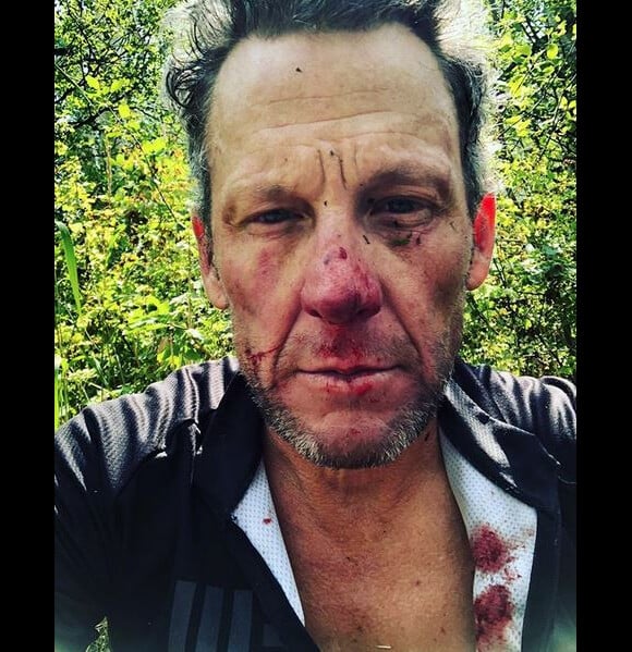 Lance Armstrong a fait une grave chute à vélo ce mercredi 8 août à Snowmass Village, dans le Colorado. L'ex-cycliste a été hospitalisé.