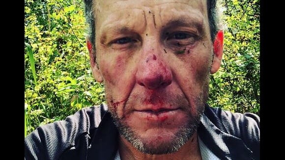 Lance Armstrong hospitalisé : Lourde chute à vélo, il révèle les dégâts