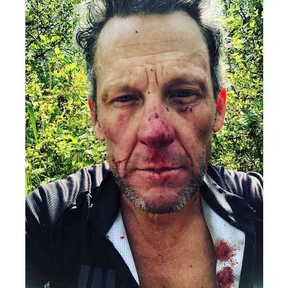 Lance Armstrong a fait une grave chute à vélo ce mercredi 8 août à Snowmass Village, dans le Colorado. L'ex-cycliste a été hospitalisé.