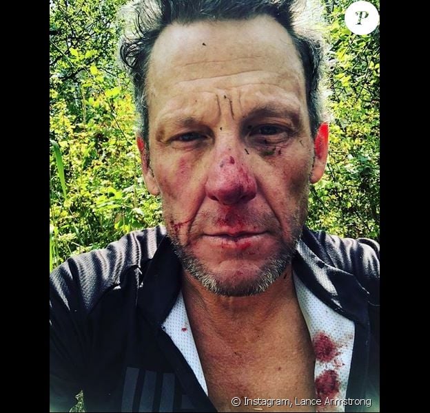 Lance Armstrong a fait une grave chute à vélo ce mercredi 8 août à Snowmass Village, dans le Colorado. L'ex-cycliste a été hospitalisé.