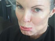 Marcia Cross (Desperate Housewives) : L'actrice souffre d'un cancer