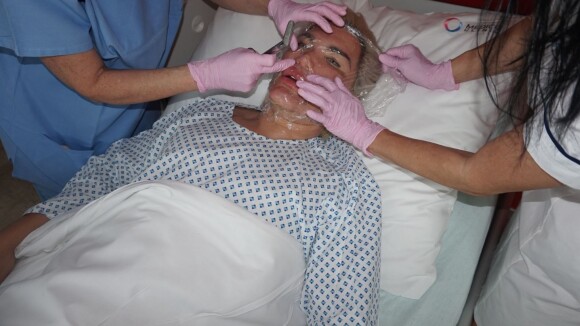 Rodrigo Alves : Nouvelles opérations pour une "rénovation complète du visage"