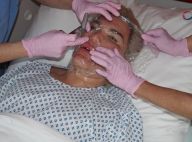 Rodrigo Alves : 70e opération de chirurgie esthétique, le Ken humain raconte