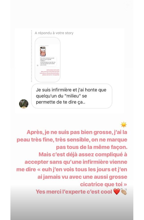 Agathe Auproux répond à une internaute qui se questionne sur sa cicatrice, dimanche 30 juin 2019 sur Instagram.