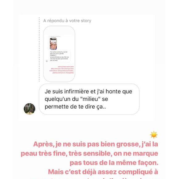 Agathe Auproux répond à une internaute qui se questionne sur sa cicatrice, dimanche 30 juin 2019 sur Instagram.