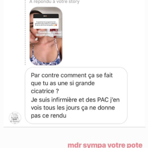 Agathe Auproux répond à une internaute qui se questionne sur sa cicatrice, dimanche 30 juin 2019 sur Instagram.