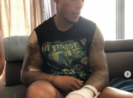 Marvin (Secret Story) victime d'un accident : photos choc de ses blessures