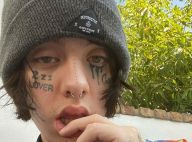Lil Xan arrête les drogues : épilepsie, urgences... son combat pour être sobre