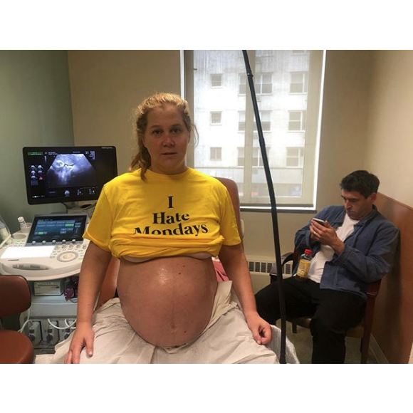 Amy Schumer sur Instagram. Naissance de son fils.