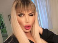 Roddy Alves : Le nouveau visage de la Barbie humaine, "féminisé" contre 30 000 €