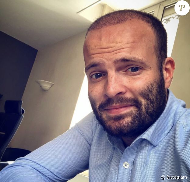 Alban, ex-candidat de "Koh-Lanta", après sa greffe de cheveux.