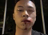 Kinstaar : Le jeune streameur agressé par un groupe, photos et récit choc