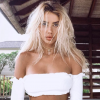 Justin Bieber : son ex Sahara Ray défigurée après une morsure de chien (Instagram).
