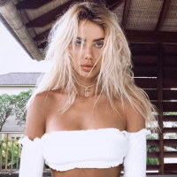 Justin Bieber : Mordue par un chien, son ex Sahara Ray était totalement défigurée