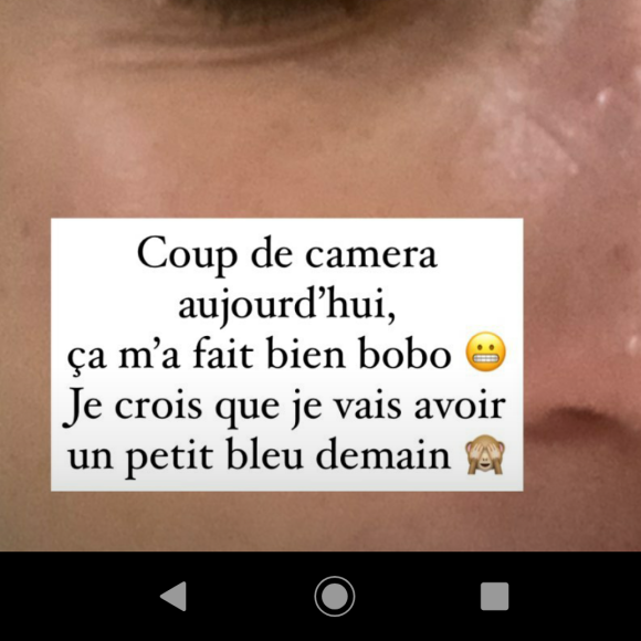Linda Hardy dévoile ses blessures sur le tournage de "Demain nous appartient" - Instagram