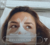Victoria Mehault (Les Marseillais) s'offre de nouvelles opérations de chirurgie esthétique - Instagram