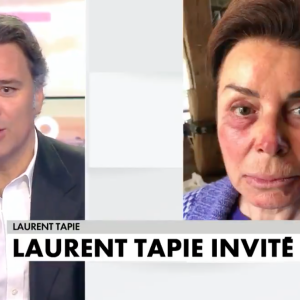 Les visages meurtris de Bernard Tapie et sa femme Dominique après leur agression survenue à leur domicile, en avril 2021.