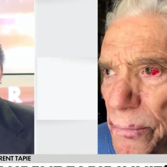 Les visages meurtris de Bernard Tapie et sa femme Dominique après leur agression survenue à leur domicile, en avril 2021.