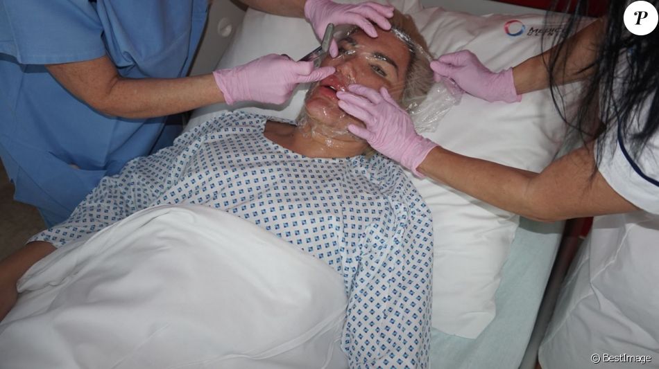 Rodrigo Alves alias "Human Ken Doll" lors d'une opération chirurgicale du visage au centre Medico Beauty & IVF de Prague, République tchèque, le 3 mai 2018.