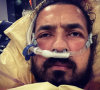 Moundir dévoile une nouvelle photo choc de lui à l'hôpital - Instagram
