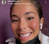 Lola de "Koh-Lanta 2020" va chez le dentiste et dévoile tout à ses abonnés, le 6 mai 2021, sur Instagram